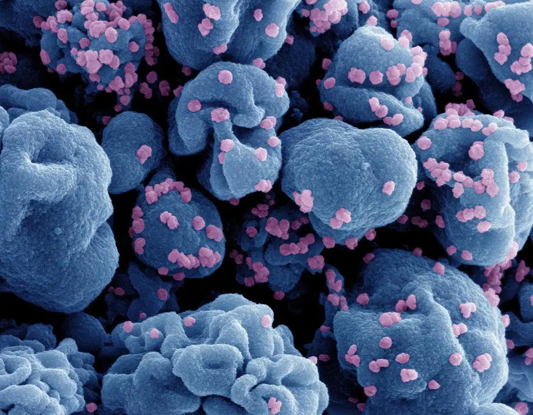 NIH-sponsored Trial Nasal Covid Vaccine Opens